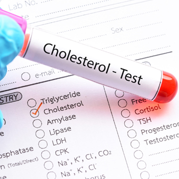 Cholesterol Testing